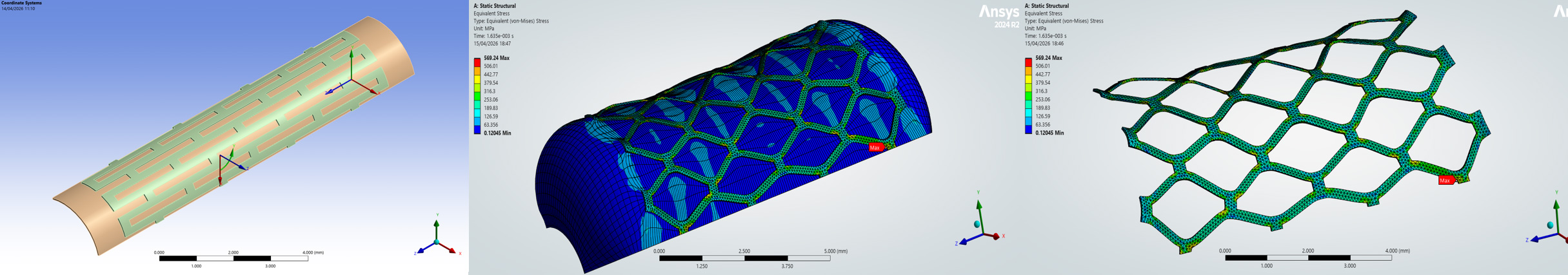 Nonlinear Simulation of Balloon-Expandable Stent Deployment