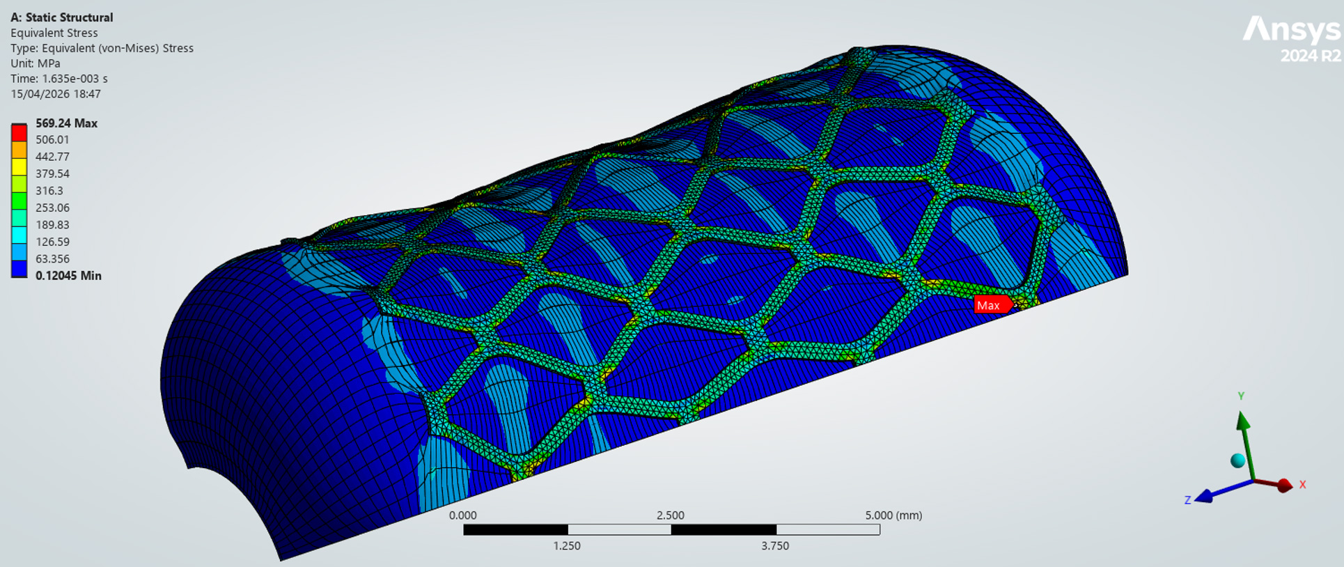 Fig 4.15 — Deformed stent at 0.409 MPa with von Mises stress contour